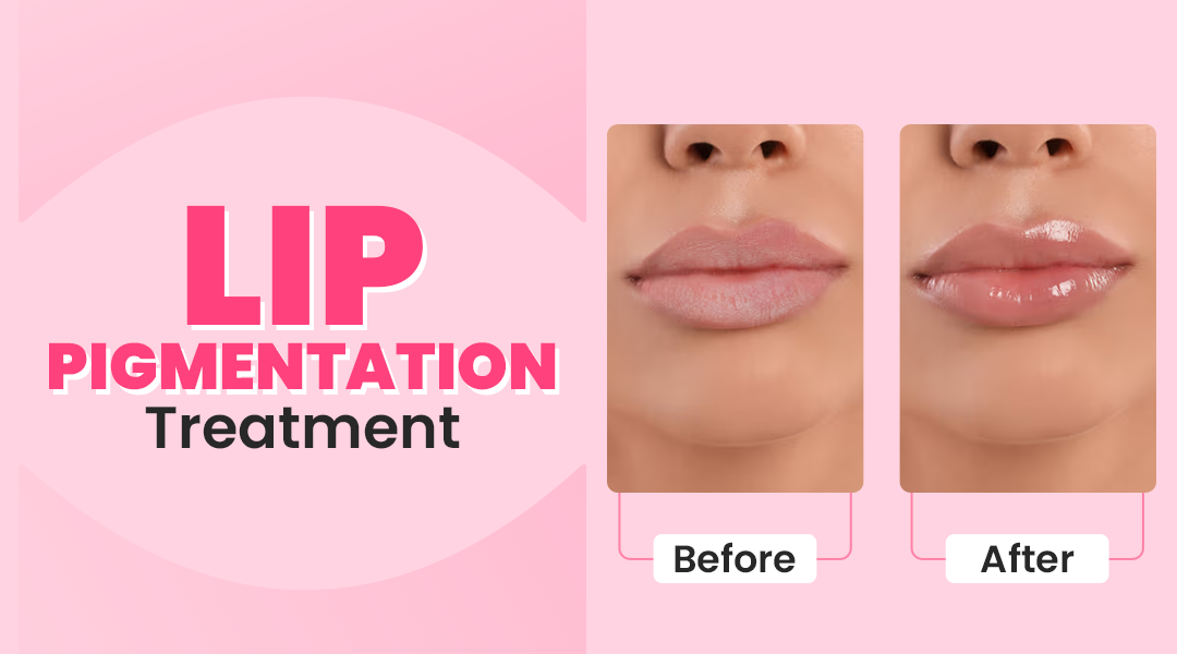 does glutathione lighten lips 20 Most Asked Questions About for Skin Kojic acidto lighten visible sun damage Lip Pigmentation Treatment Cost |