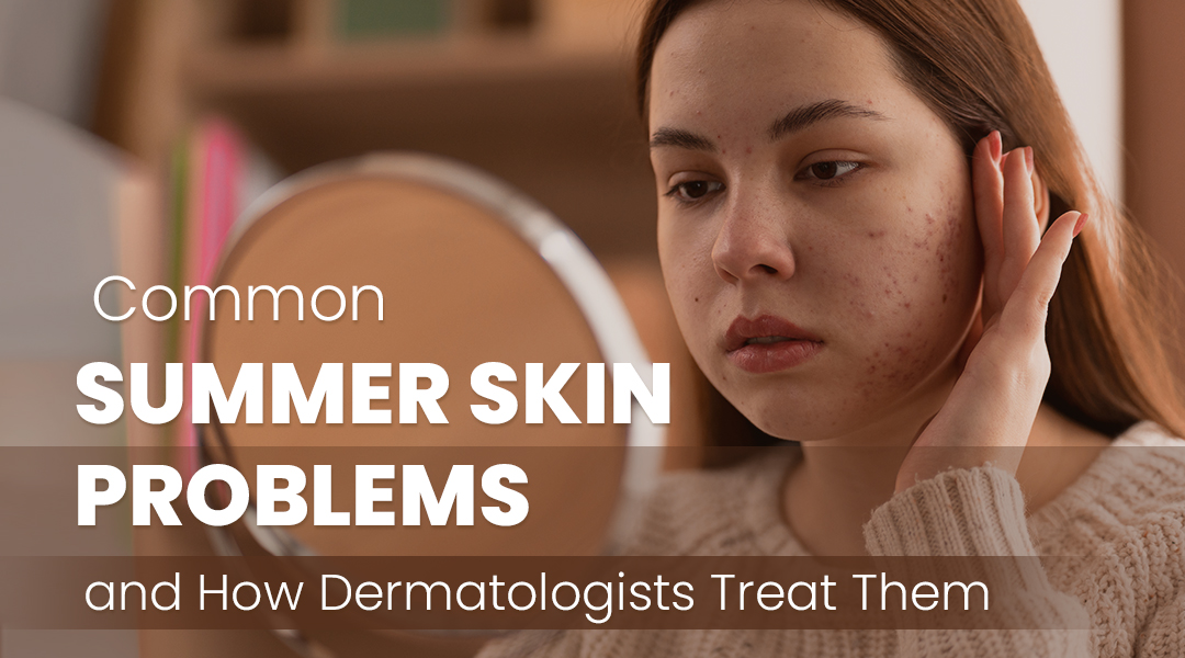 Common Summer Skin Problems and How Dermatologists Treat