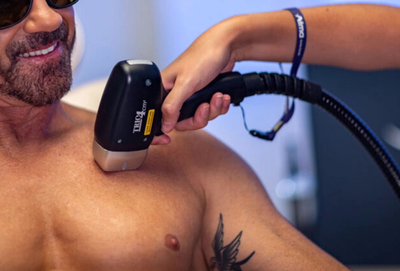 Upper Body Laser Hair Removal for Men